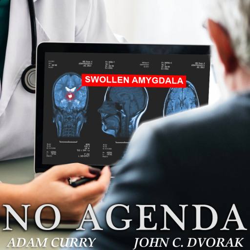 Amygdala by Art-By-Jordan